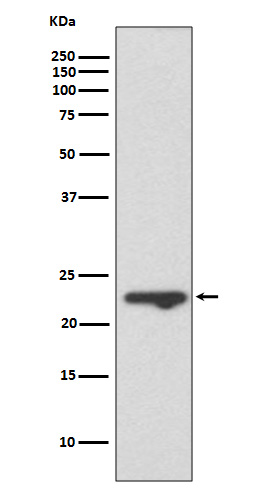 WB - Anti-MUC1 Rabbit Monoclonal Antibody ABO13419